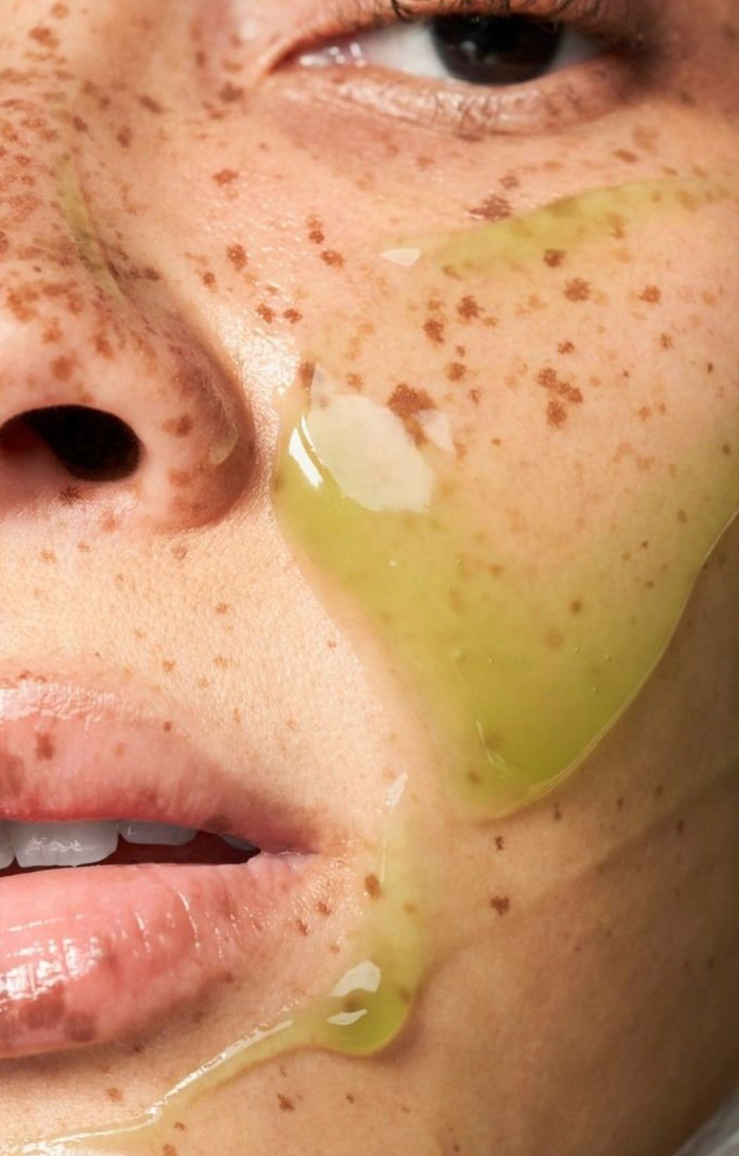 Green Algae Peel Treatment